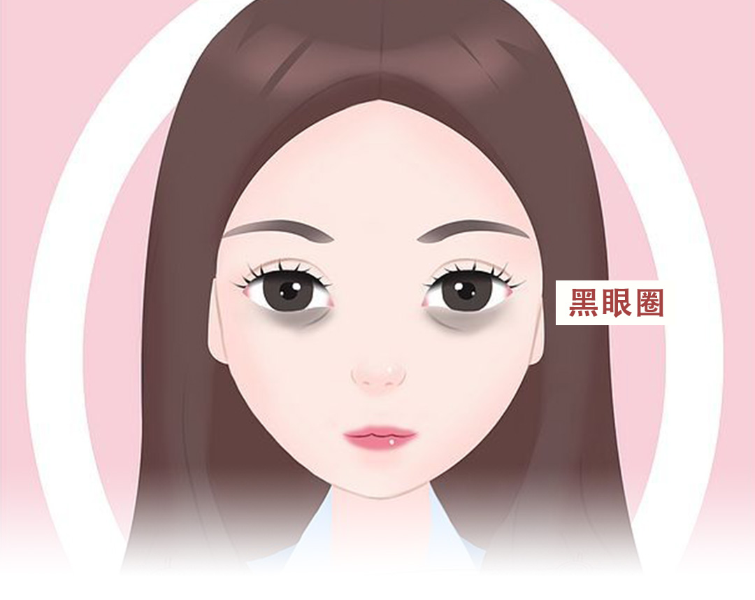 黑眼圈