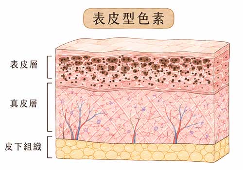 除斑雷射1