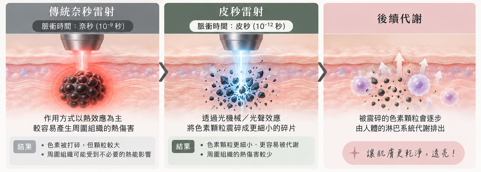 皮秒雷射多久打一次2