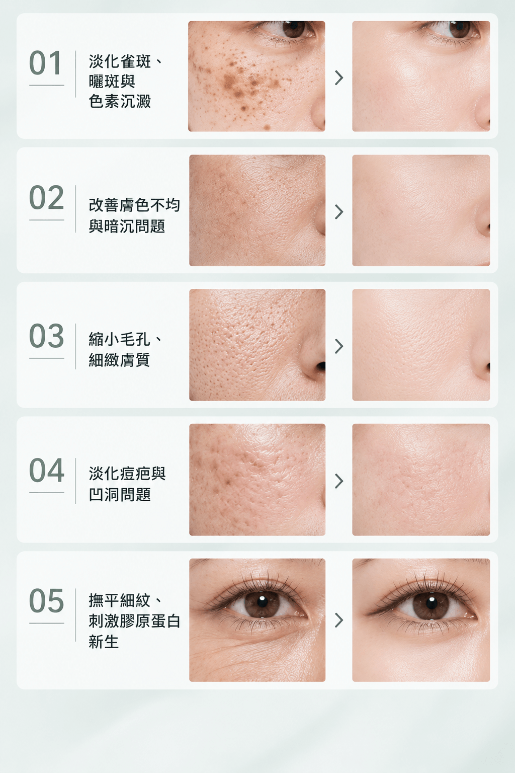 皮秒雷射多久打一次3